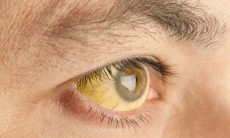 454004 karkinos sto pagkreas 7 agnosta simadia tou epithetikou karkinou pou sychna pernoun aparatirita.jpg