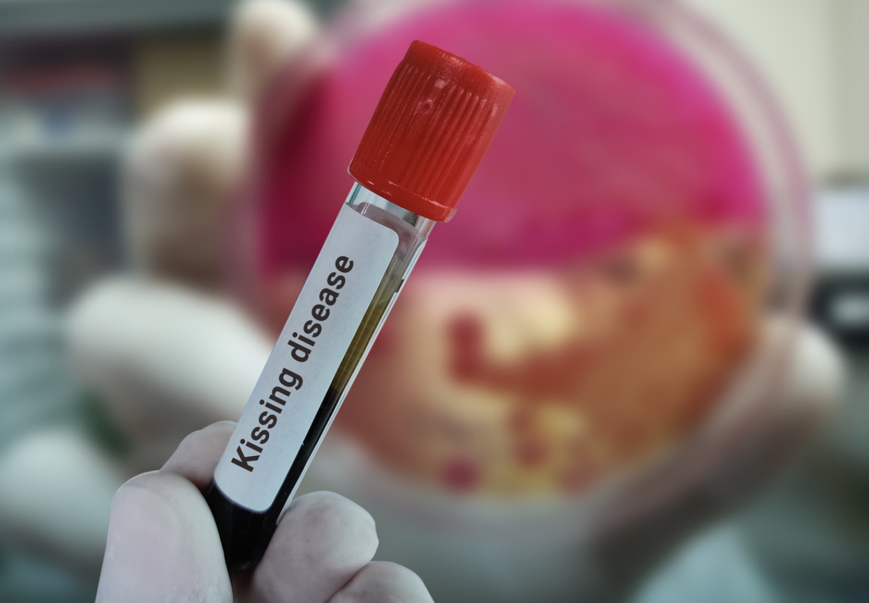 454808 sklirynsi kata plakas synithismeni loimoxi ton neon triplasiazei ton kindyno.jpg